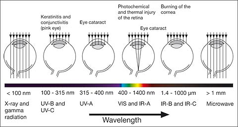 eye-injuries.jpg